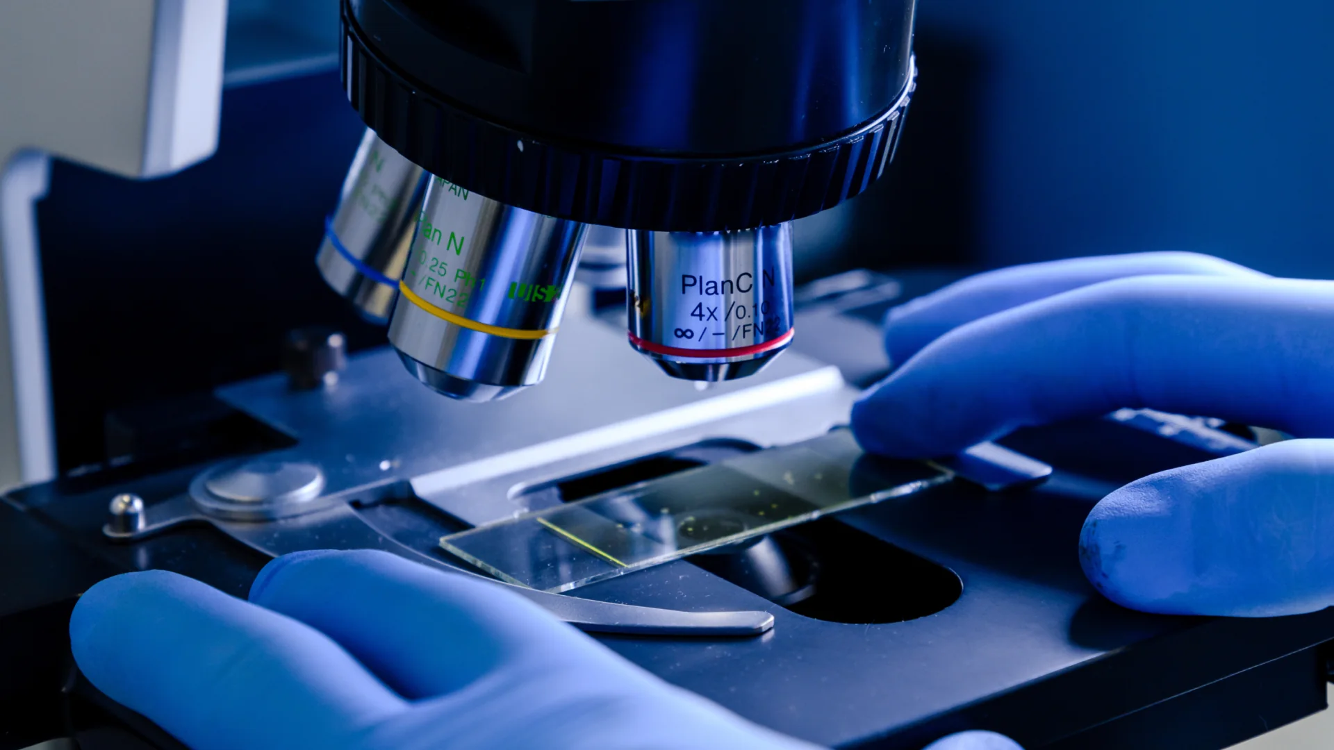Synevo case study: diagnostic laboratory microscope and gloved hands